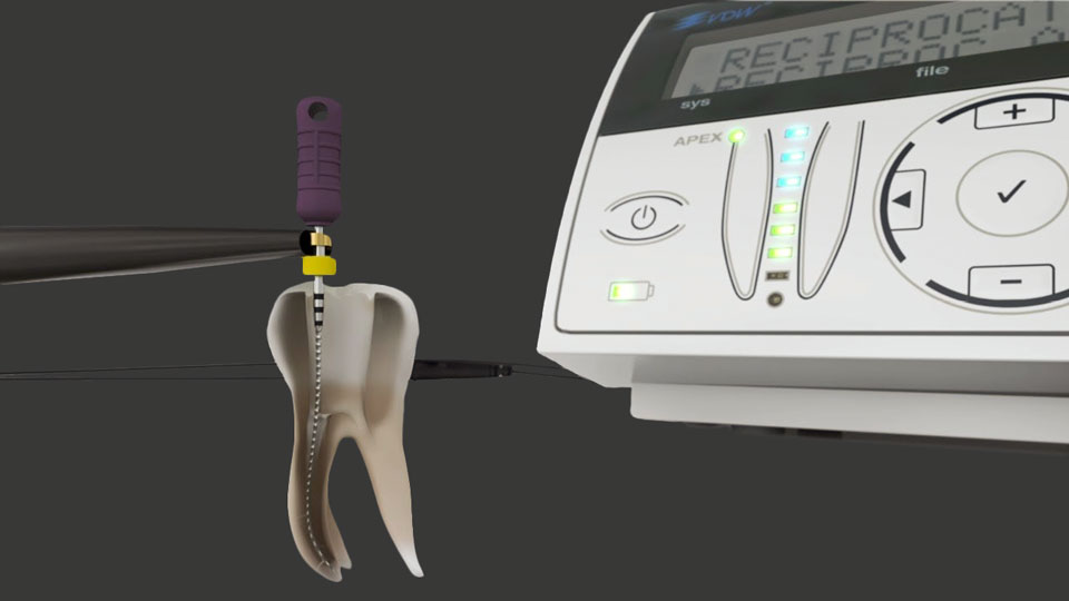 Abbildung des Geräts