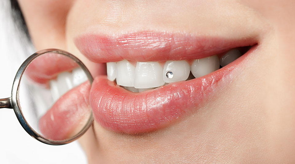 Strass-Steinchen auf Zahn